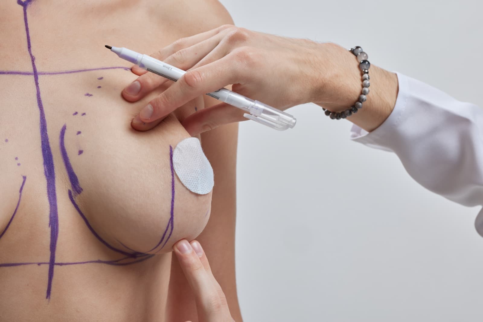 Corrigindo deformidades após a cirurgia de mama